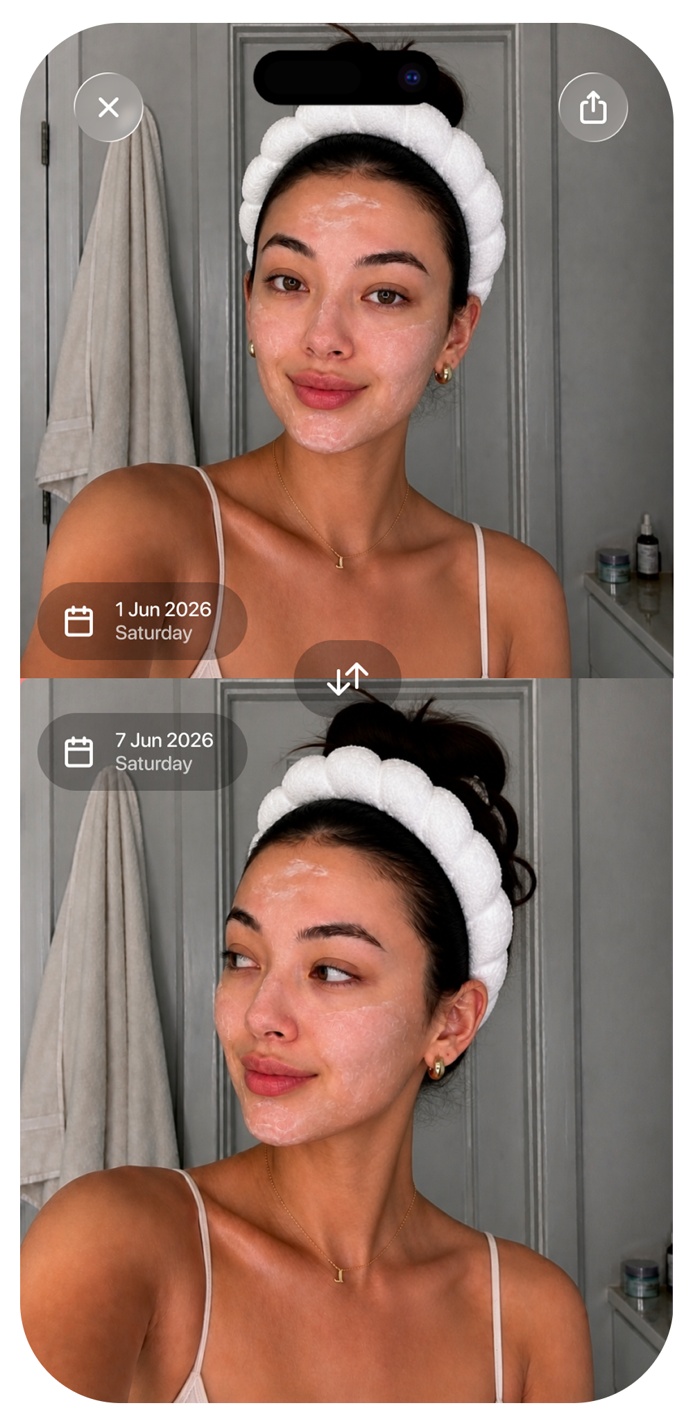 A before-and-after Compare view of skin over time